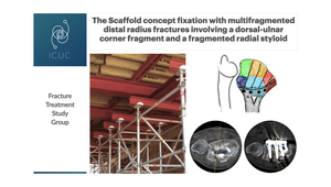 scaffolding essed